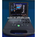 DW-C60 laptop basic 4D function equipment color doppler portable ultrasound machine